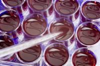 Hot topics: Cloning and stem cell research taking samples from test tubes filled with blood